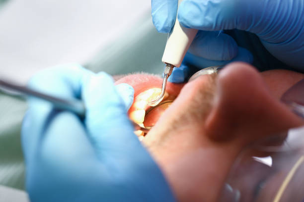 Best Cosmetic Emergency Dentistry in Paxton, IL