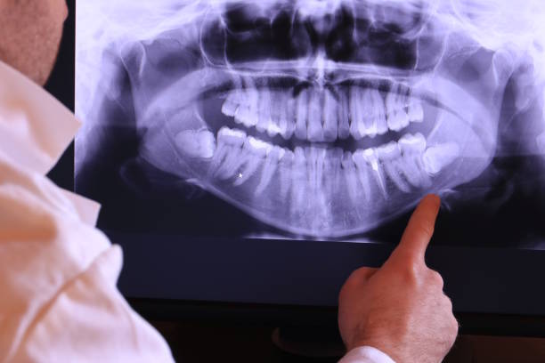 Best Emergency Treatment for Dental Infections or Abscesses in Paxton, IL